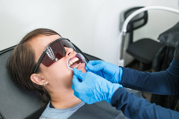 Best Knocked-Out Tooth (Avulsed Tooth) Treatment in Elmhurst, IL